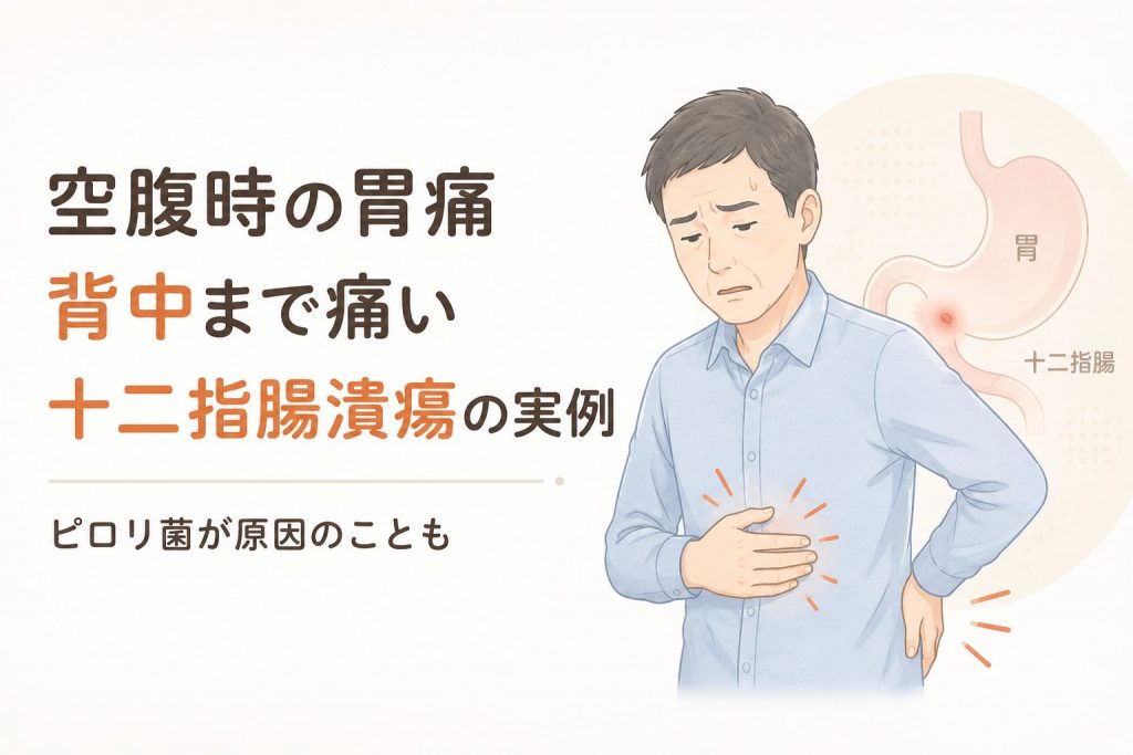 空腹時の胃痛と背中の痛みの原因は？十二指腸潰瘍の実例｜池袋上田胃腸